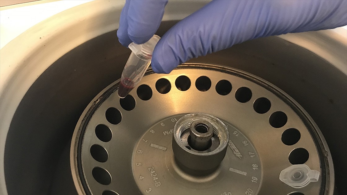 Serebral Palsi Tanısı İçin 'genetik Test Yaptırın' Uyarısı