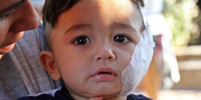 Antalya’da Vahşi Köpek Pitbull Dehşeti