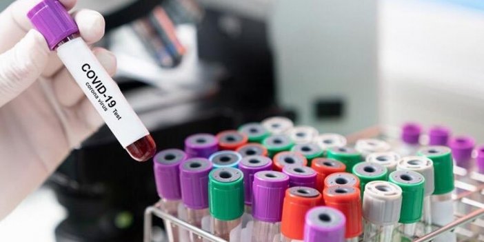 Rusya’da bin 123 korona nedenli vefat ile yeni rekor kırıldı