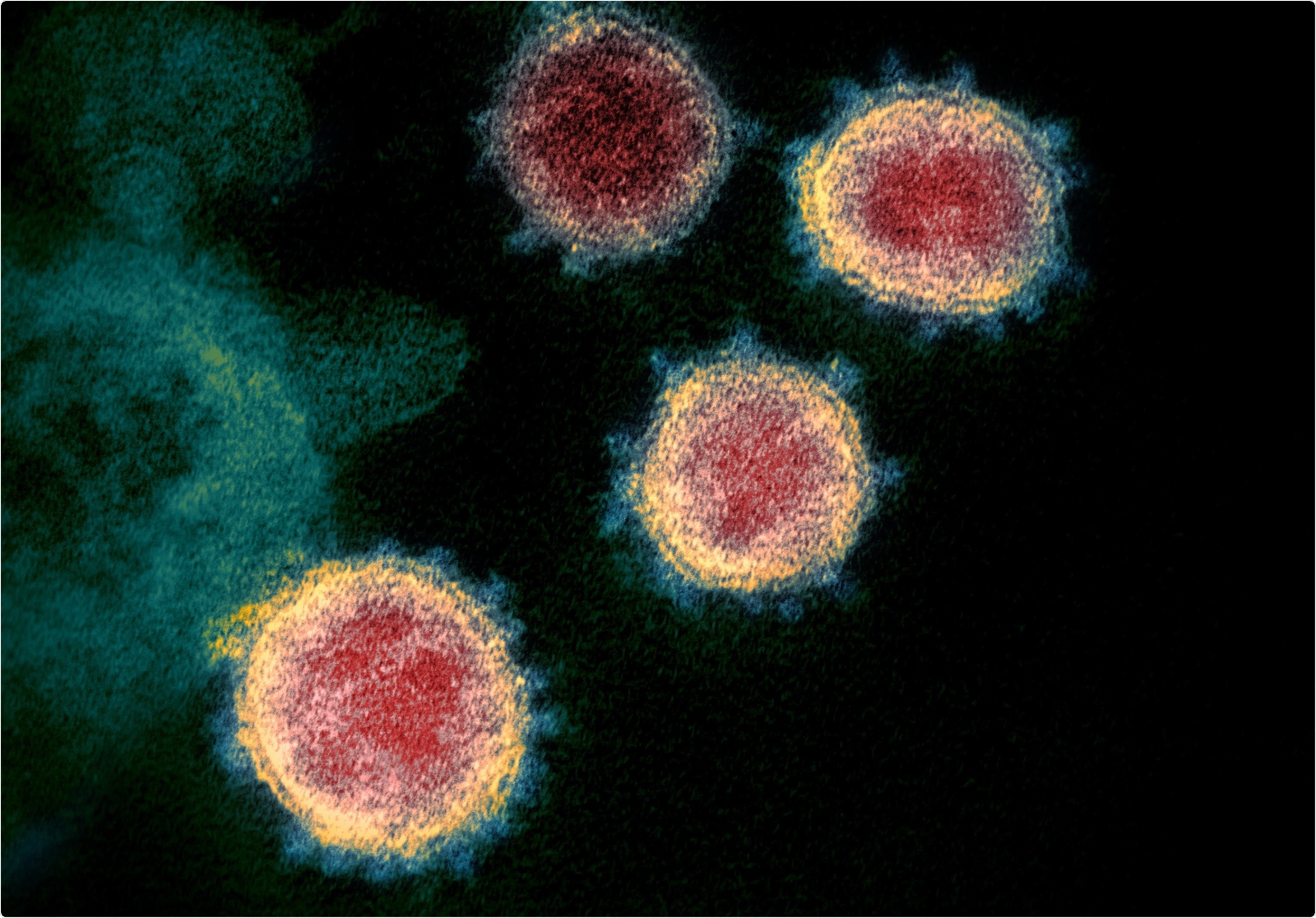 Fransa’da kuş gribi alarmı en yüksek seviyede