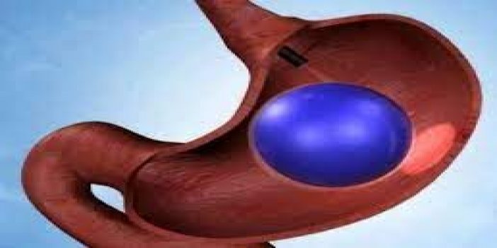 "Mide balonu kilo kaybını azaltırken yaşam kalitesini yükseltiyor"