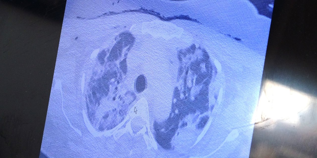 Prof. Dr. Özkaya: "Virüs artık akıllı bir organizma gibi davranıyor"