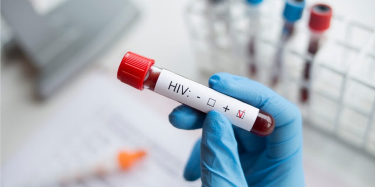 1 Aralık Dünya AIDS Günü: AIDS nedir, belirtileri nelerdir?
