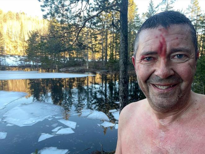 Doğum gününde hayranlarına "Ben ölmedim" diye seslenen ünlü YouTuber birkaç gün sonra feci şekilde can verdi