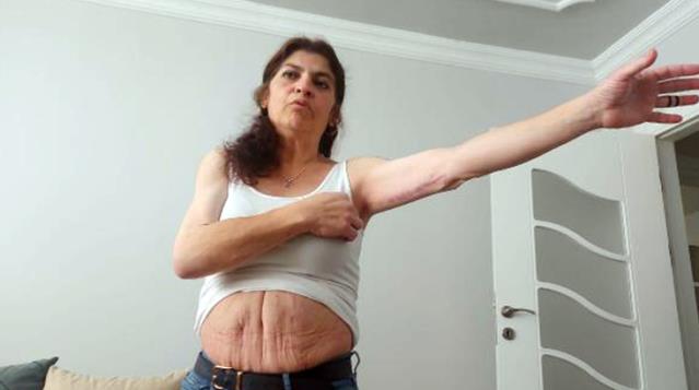 Estetik sonrası hayatı kabusa dönen kadın, yaşadığı acı dolu süreci anlattı: Rüyalarımda doktor gözlerimi oyuyordu