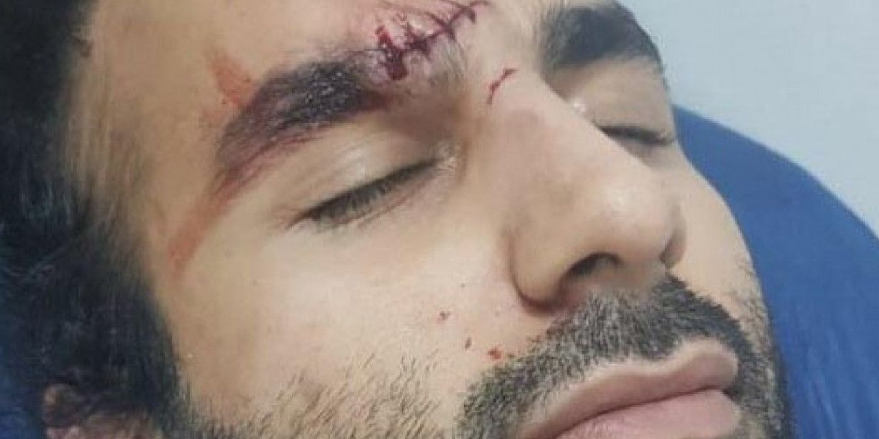 Aydın'da saldırıya uğrayan doktor: Neden yaptığına anlam veremedim