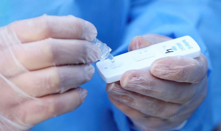 Yunan hükümeti koronavirüs testleri için kararını verdi