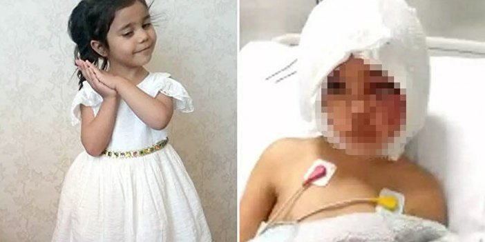 Pitbull Saldırısına Uğrayan Asiye'nin Sağlık Durumuna İlişkin Açıklama