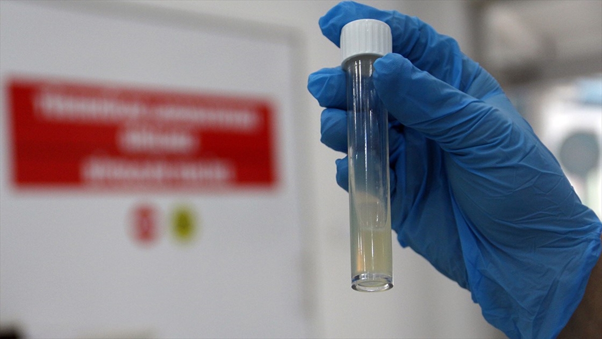 Tüberkülozda Erken Tanı Sürecini Hızlandıran Yeni Yöntem Kullanıma Sunulacak