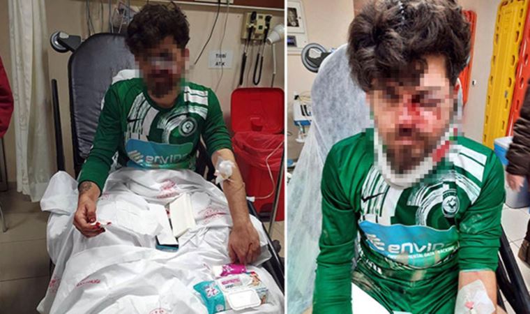 Rakibinin yüzüne tekme atmasıyla yaralanan amatör futbolcuya Kırklareli'de destek