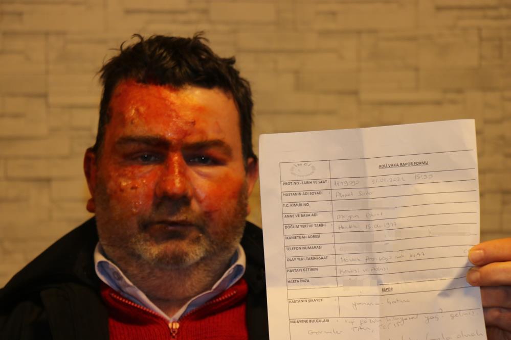 Derin uykuda dehşeti yaşadı diri diri yanarken uyandı