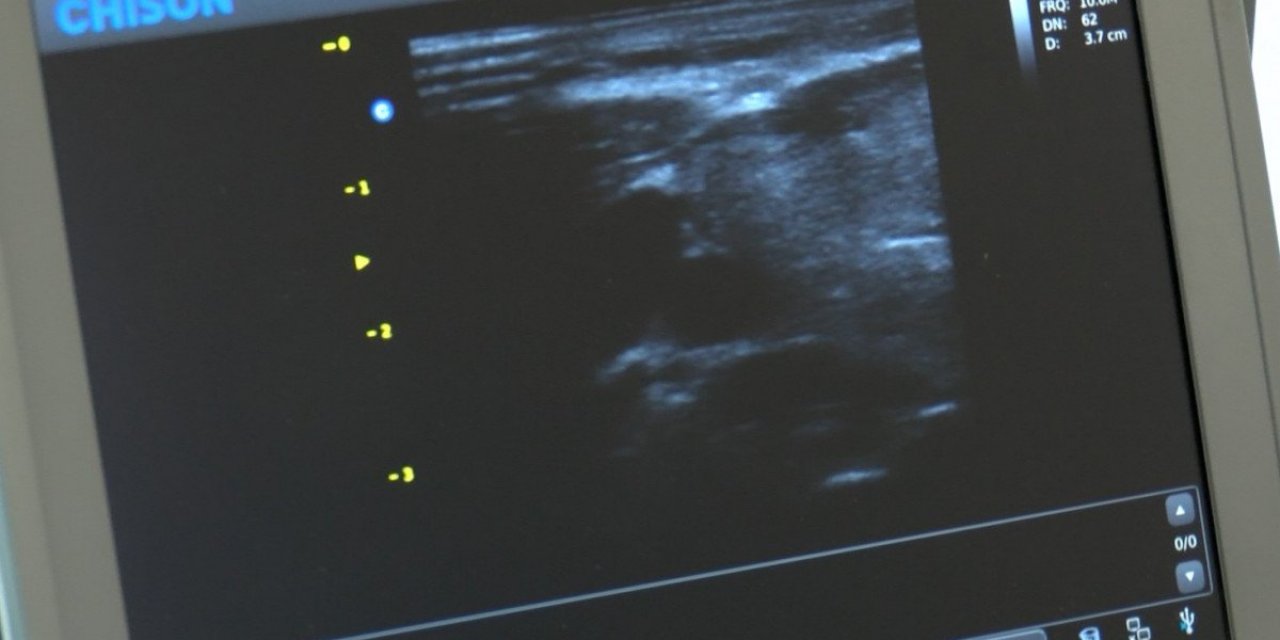 Trabzon'da, hastalığı ile annesinin hastalığına şifa oldu