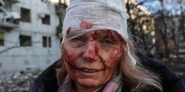 Savaşın Simgesi Fotoğrafın Detayları Yürek Burktu