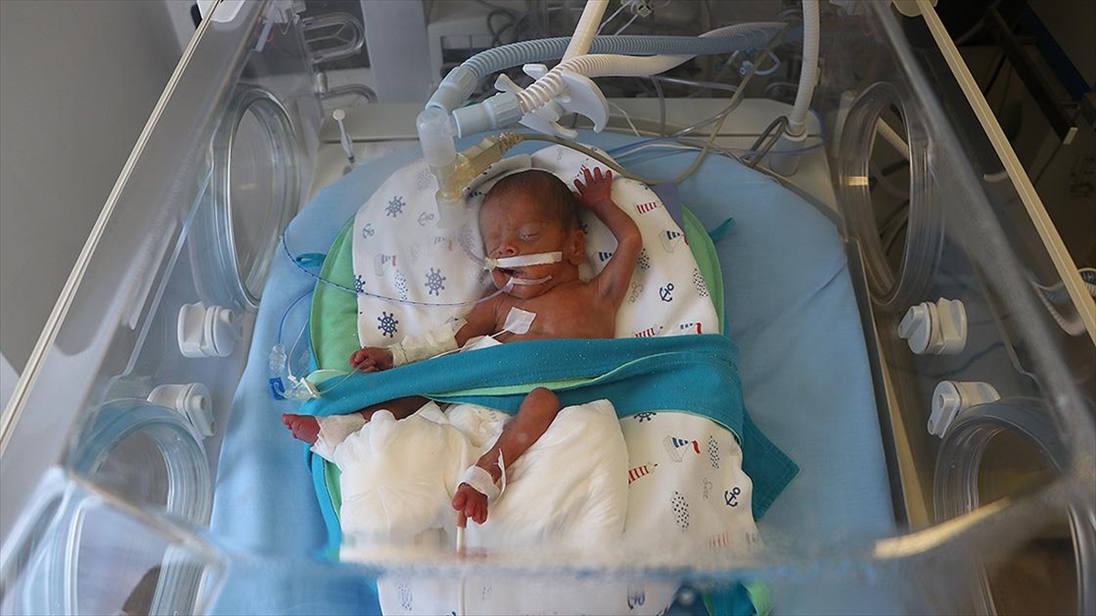 'Parmak Bebek' Yavuz Selim Kök Hücre Nakliyle Hayata Tutundu