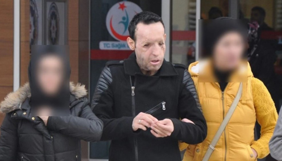 Çene nakli olan ilk kişiydi! Recep Sert, uyuşturucu operasyonunda gözaltına alındı