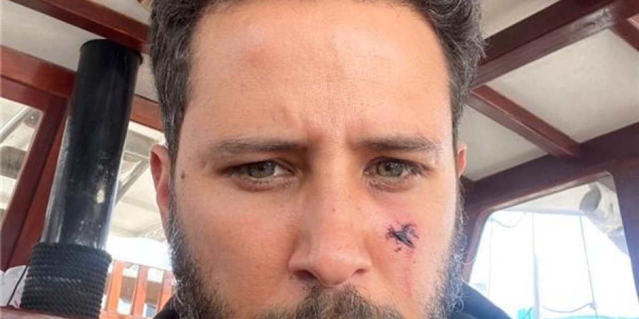 Tuan Tunalı'ya köpek saldırdı