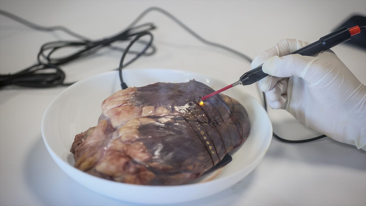 Seyyar Elektrokoter Cihazı Hayat Kurtaracak