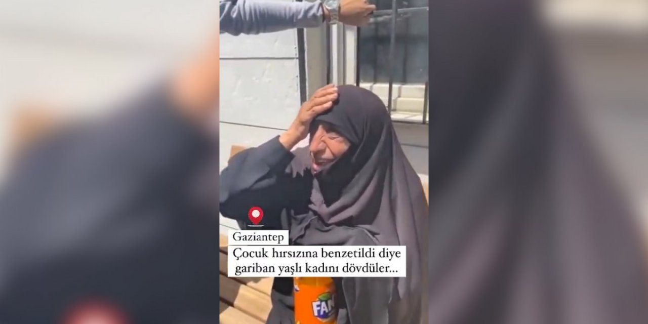 Gaziantep Valisi Davut Gül'den darbedilen Suriyeli kadın paylaşımı