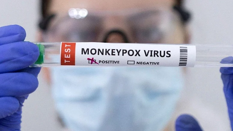 Türkiye'de 5 maymun çiçeği vakası tespit edildi