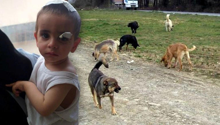 Ağrı'da köpeklerin saldırdığı çocuktan acı haber..