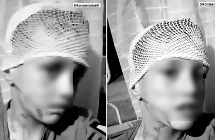 Suriyeliler, istedikleri parayı vermeyen çocuğun yüzüne kezzap attı iddiası