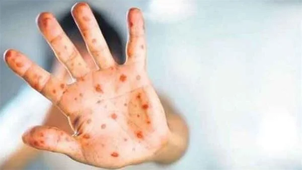 Korkutan uyarı geldi: Domates virüsüyle ilgili yeni detay!