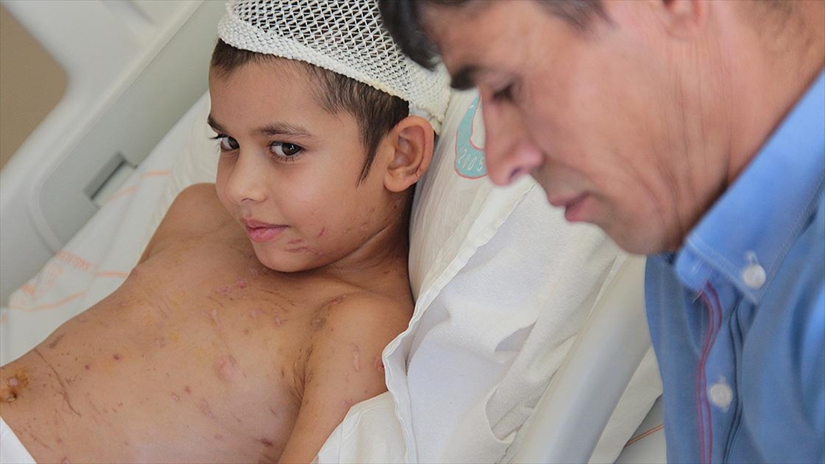 Sahipsiz Köpeklerin Saldırdığı Küçük Umut 24 Gün Sonra Taburcu Edildi