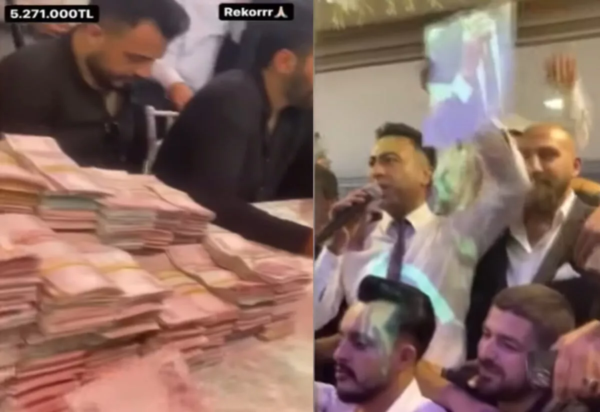 5 milyonluk sünnet ağızları açık bıraktı