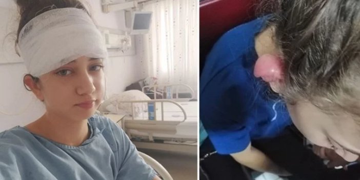 Takıcılarda Kulak Deldirdi, Sağlığından Oldu!