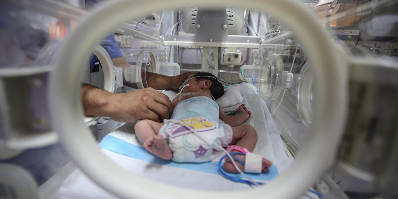 İngiltere'de İki Hastanede En Az 45 Bebeğin Ölümünün Önlenebileceği Ortaya Çıktı