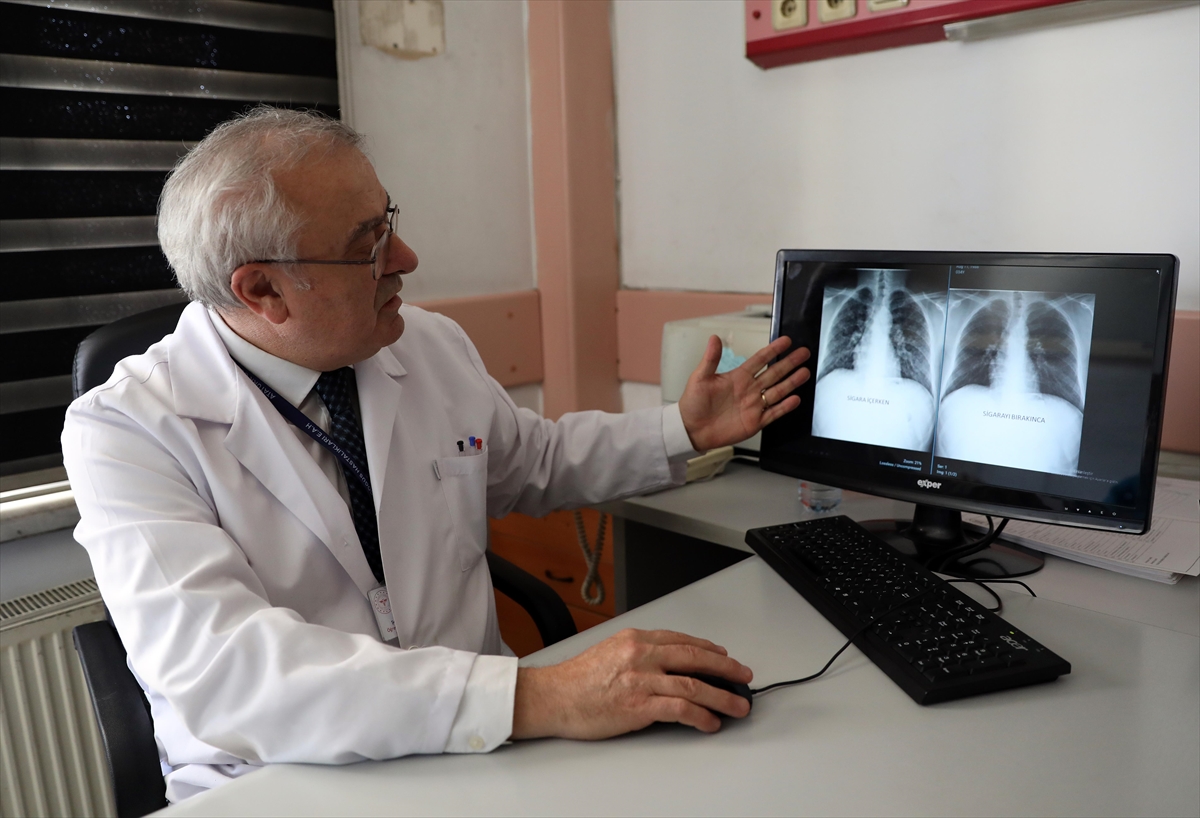 Ölümcül Akciğer Hastalığını Sigarayı Bıraktıktan Sonra Yendi