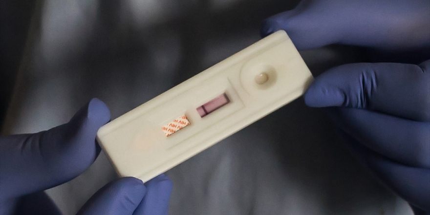 Tüm Gebelere Hıv Taraması