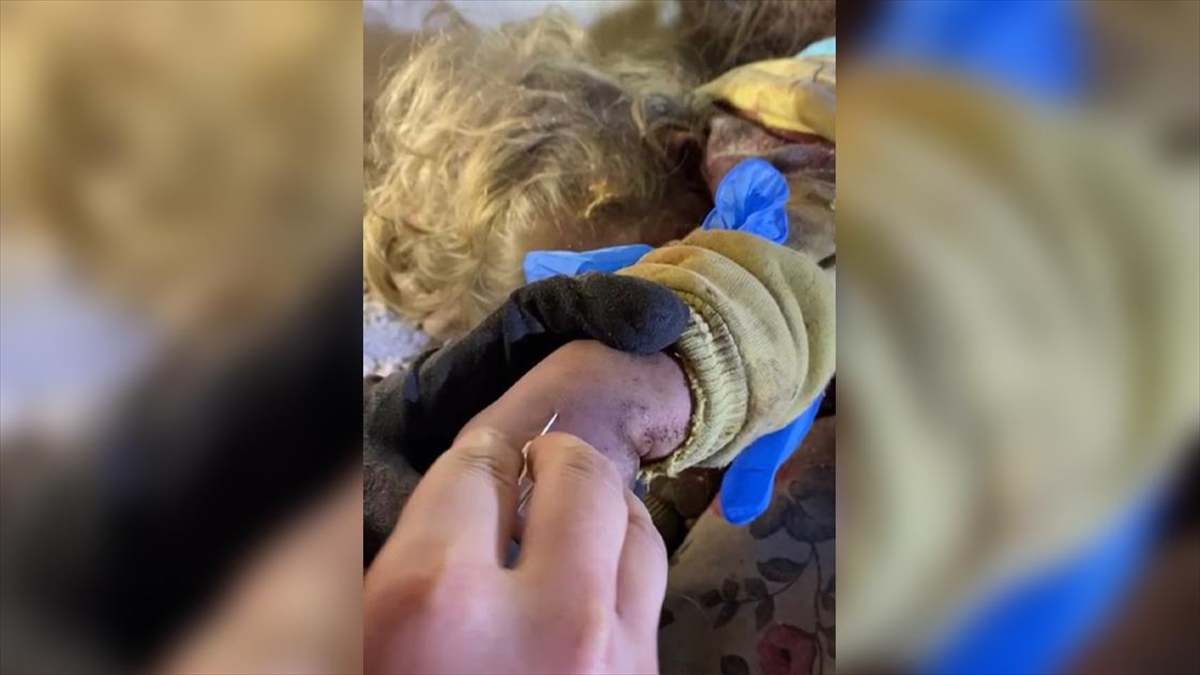 Umke'nin Enkaz Altında Kalan 3 Yaşındaki Buse'ye Müdahale Etti