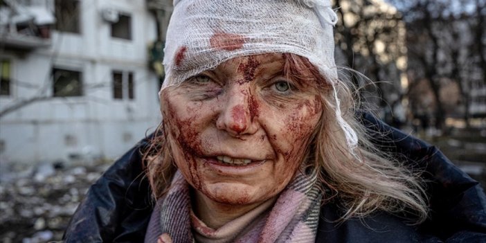 Rusya-ukrayna Savaşının Üzerinden 1 Yıl Geçti