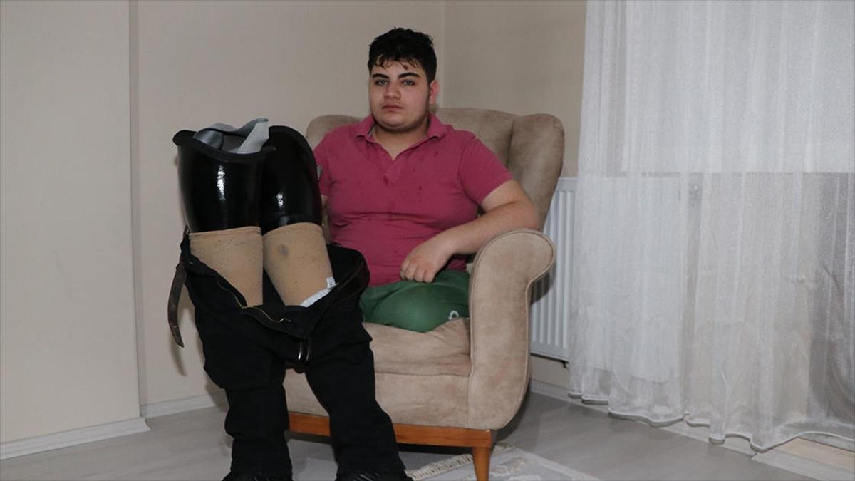 Doğuştan İki Bacağı Olmayan Miraç, Küçülen Protezlerinin Yenilenmesini İstiyor