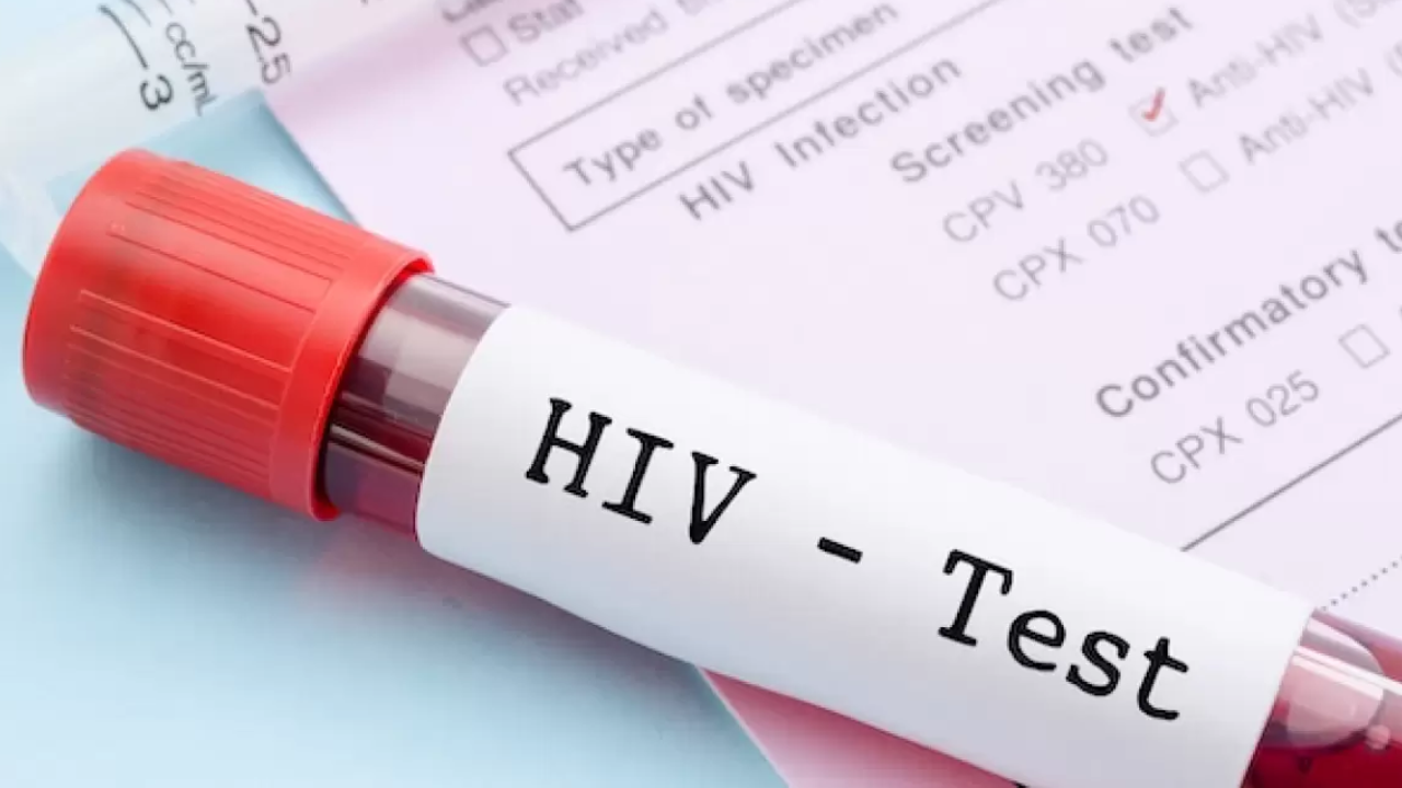 "Kızılay’dan verilen kanda HIV tespit edildi" haberlerine erişim engeli