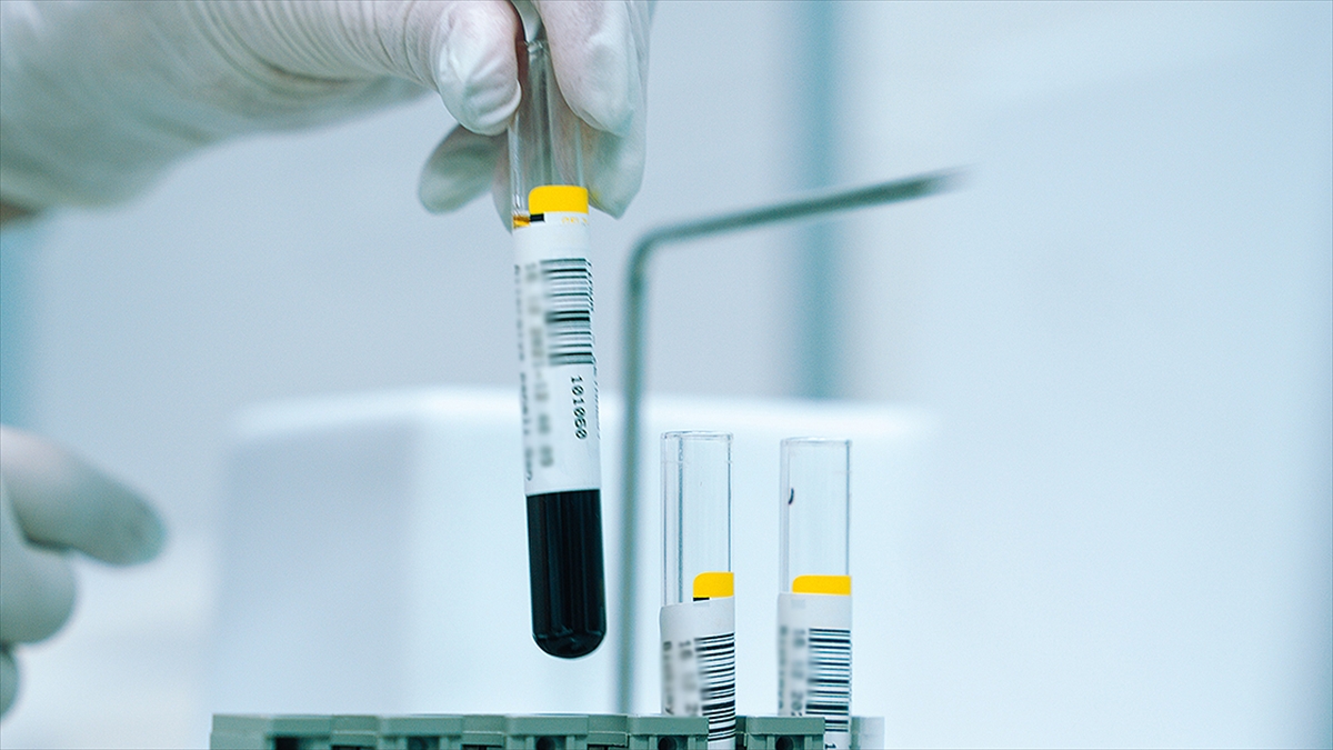 Türkiye'de Nüfusun Yüzde 2,1'i Akdeniz Anemisi Hastalığını Taşıyor