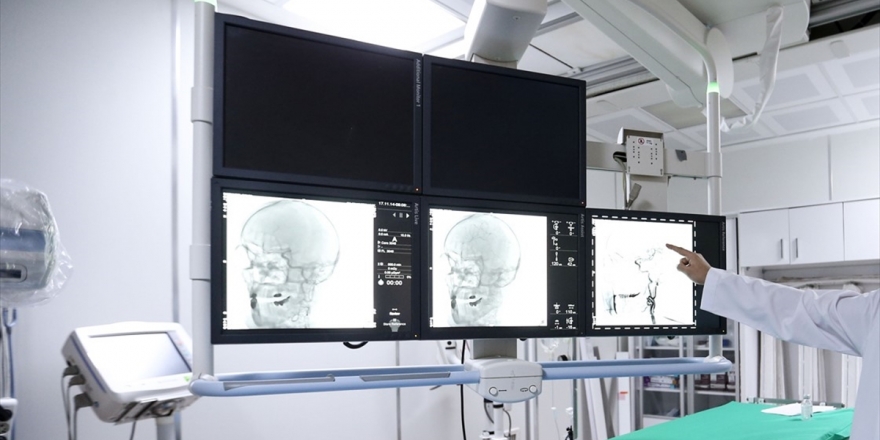 Akut İnmeye Müdahale Edecek Hekimleri Bakanlık Belirleyecek