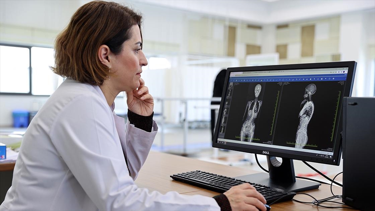 Çocuklarda Skolyozun Erken Tanısında Ebeveynlere De Görev Düşüyor