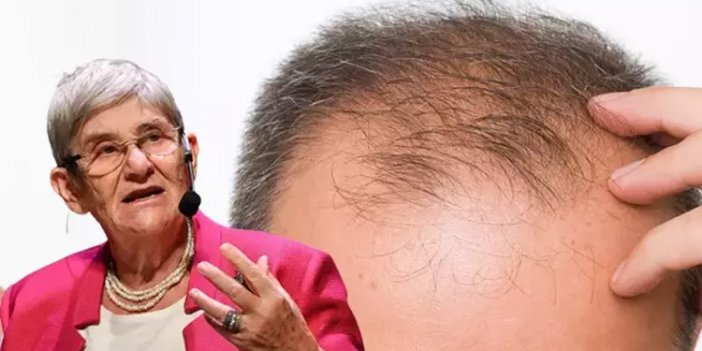 Keyifle yiyorsunuz ama bu besin kelliğe yol açıyor