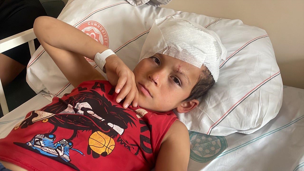 Sivas'ta Sahipsiz Köpeğin Saldırısında Yaralanan Çocuk 4 Ameliyat Geçirdi