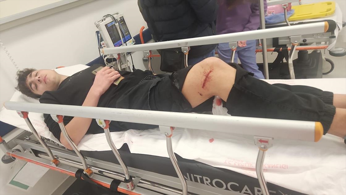 Ankara'da Bir Öğrenci Daha Okula Giderken Sahipsiz Köpeklerin Saldırısına Uğradı