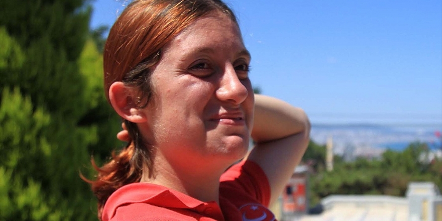 Topuz Yaptığı Saçları Dünya Şampiyonluğuna Mani Oldu