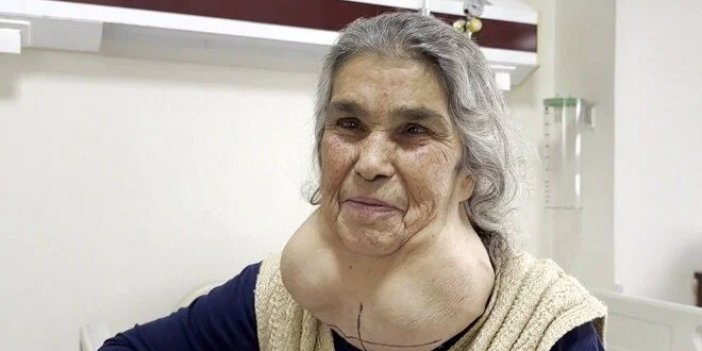 Doktor korkusundan 50 yıl böyle yaşadı!