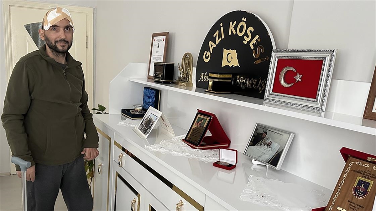 Yeniden Üniforma Giymek İsteyen Gazi 7 Yılda 14 Kez Ameliyat Oldu