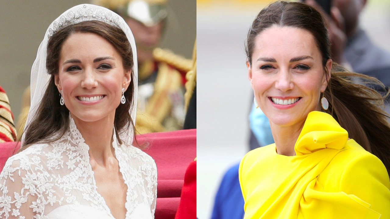 Kate Middleton hastaneye yatırıldı