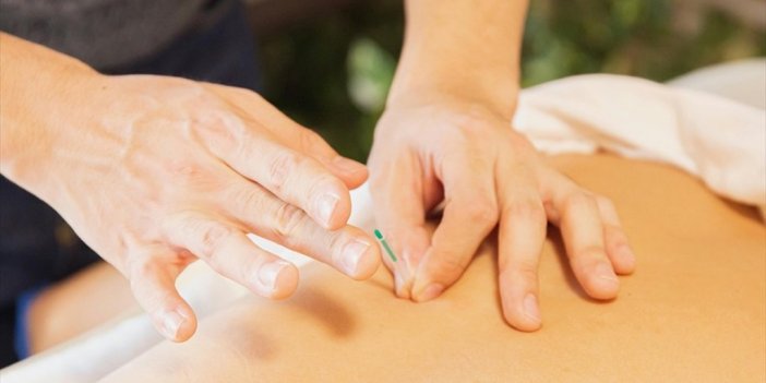 Akupunkturun bir faydası daha ortaya çıktı