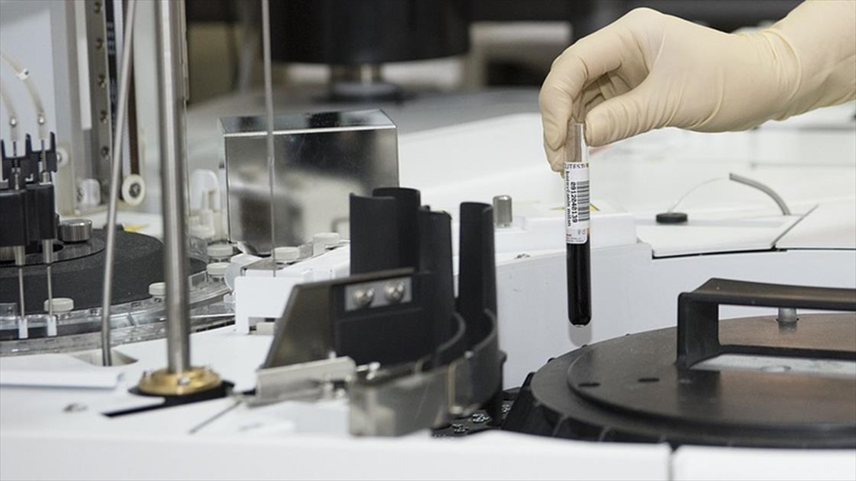 Abd'de Bir Kişi Hıyarcıklı Veba Teşhisiyle Tedavi Altına Alındı