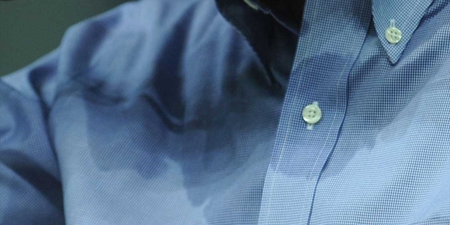 'Aşırı Terleme Sosyal İzolasyona Neden Oluyor'