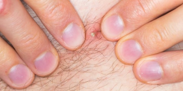 Kıllarını almak istedi, komaya girdi